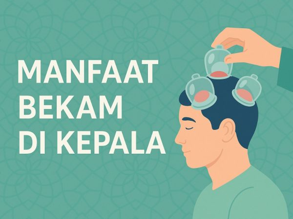 Manfaat Bekam di Kepala: Terapi Sunnah untuk Kesehatan Holistik