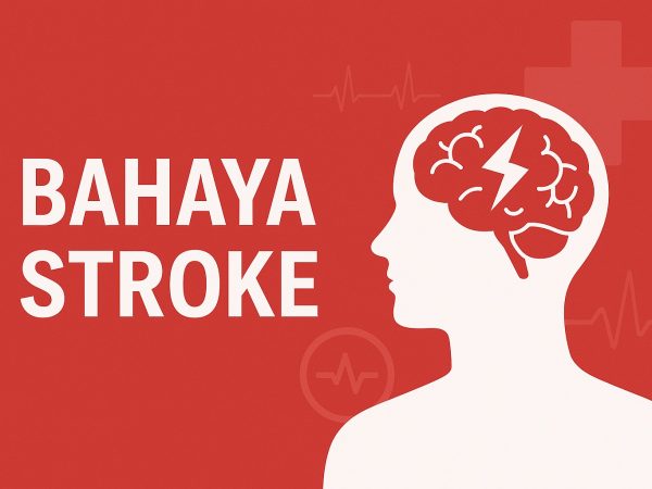 Bahaya Stroke: Mengenali, Mencegah, dan Menanggulangi Risiko Serangan Otak