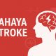 Bahaya Stroke: Mengenali, Mencegah, dan Menanggulangi Risiko Serangan Otak