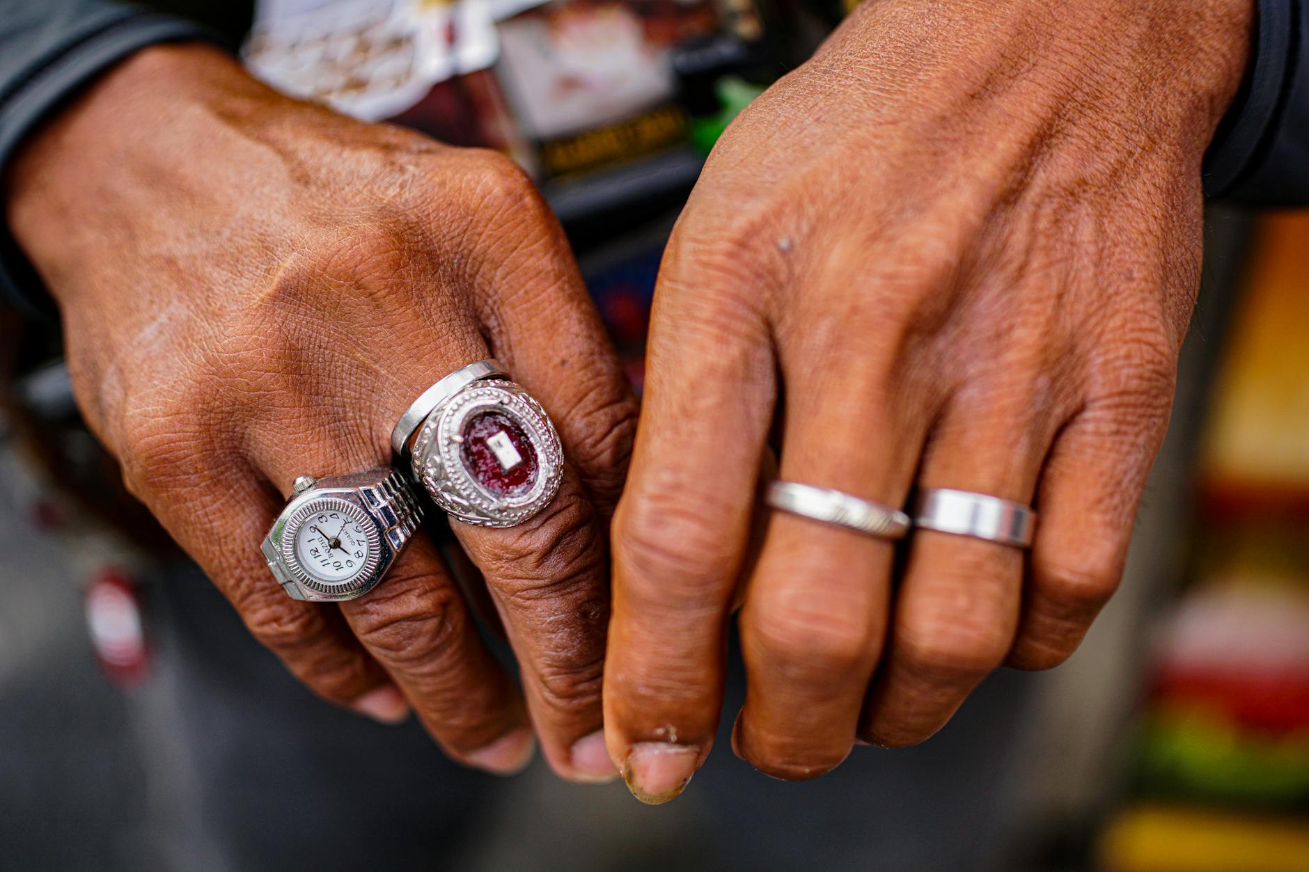 Sunat super ring, alat modern untuk pemotongan kelamin anak dengan teknik minimal invasif