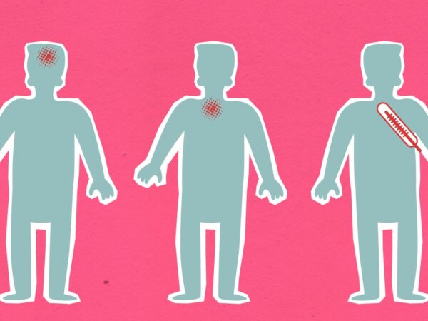 Manfaat bekam: Kisah Ibu 45 Tahun Atasi Sakit Punggung dalam 7 Hari