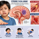 BAHAYA STROKE PADA ANAK: FAKTOR RISIKO, GEJALA, DAMPAK, DAN UPAYA PENCEGAHAN